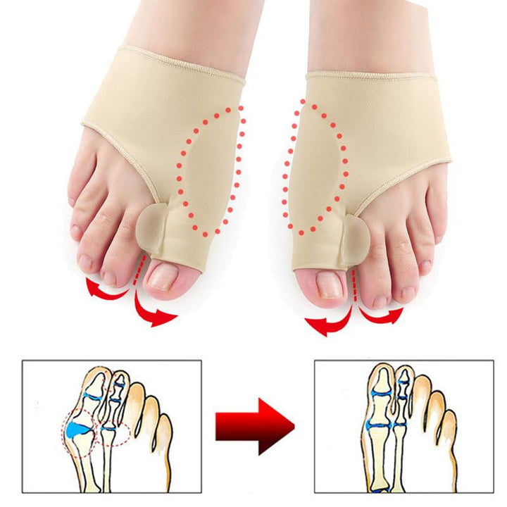Hallux Valgus Ochraniacz (1 para) - OrthoBunion